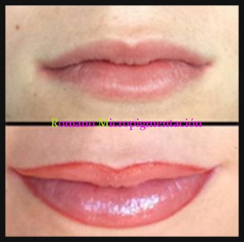 Foto Romano Micropigmentaci�n y Est�tica
